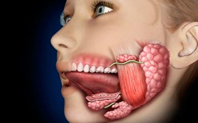 Ang salivary gland sa ilalim ng dila ay naging inflamed: mga palatandaan, larawan, sanhi at paggamot