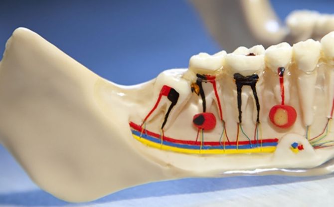 Tooth cyst: sanhi, sintomas, konserbatibo at paggamot sa bahay