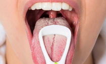 Candidiasis stomatitis: sanhi, sintomas, gamot at alternatibong paggamot