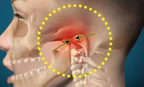 Proč z jedné nebo ze dvou stran bolí čelist blízko ucha, možnosti léčby