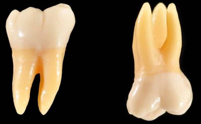 Anong mga ngipin ang tinatawag na molars at premolars, mga tampok na anatomikal