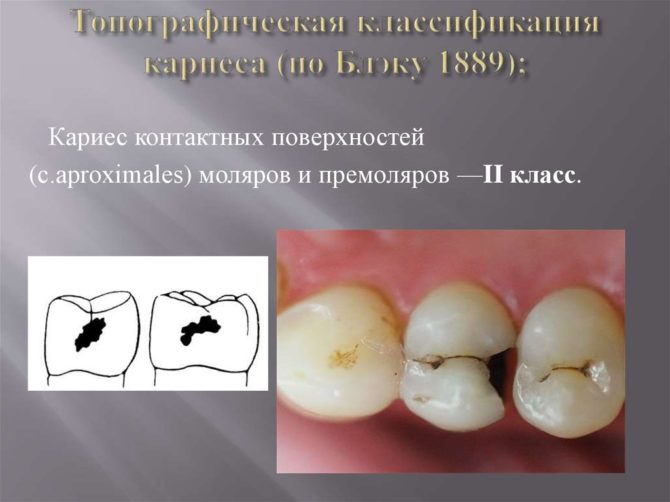 Černá třída 2