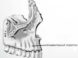 Alveolární kost