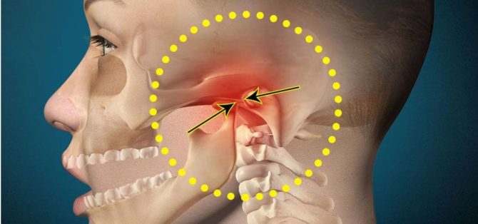 Douleur dans la mâchoire près de l'oreille