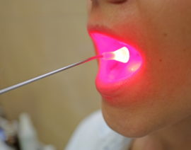 Photodynamic Therapy