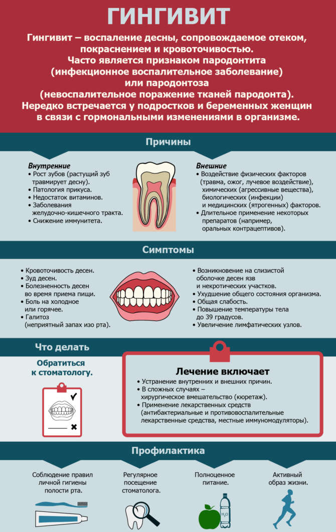 Gingivitis - infograpics