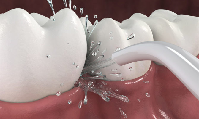 Infographie de la façon dont le brossage des dents est effectué par irrigateur.