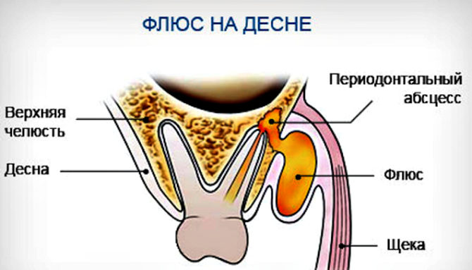 Mécanisme de formation de flux de gomme