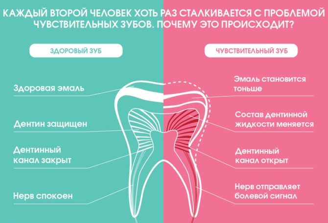 Mechanismus bolesti při hyperestezii