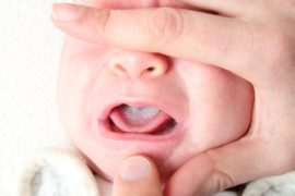 Grive dans la bouche d'un enfant