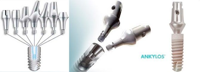 Aleman implant system Ankylos