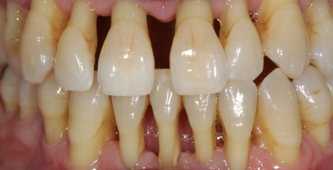 Periodontal Dentistry