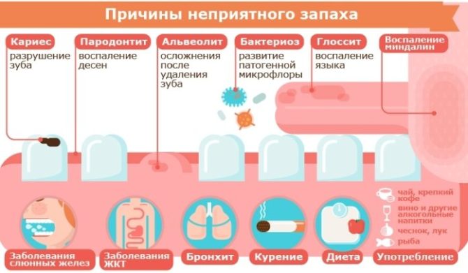 Causes de la mauvaise haleine