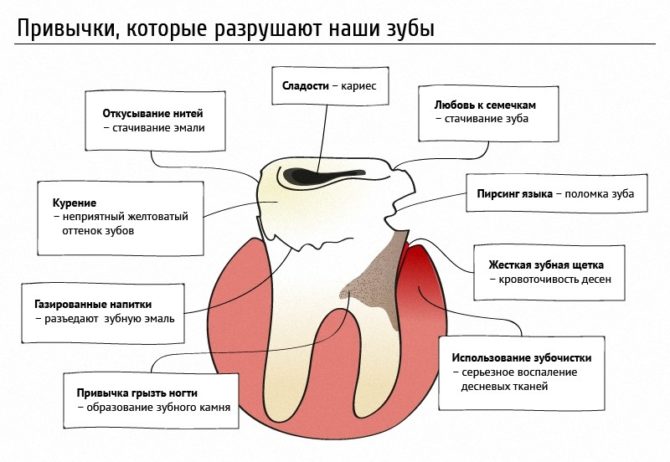 Habitudes qui détruisent les dents