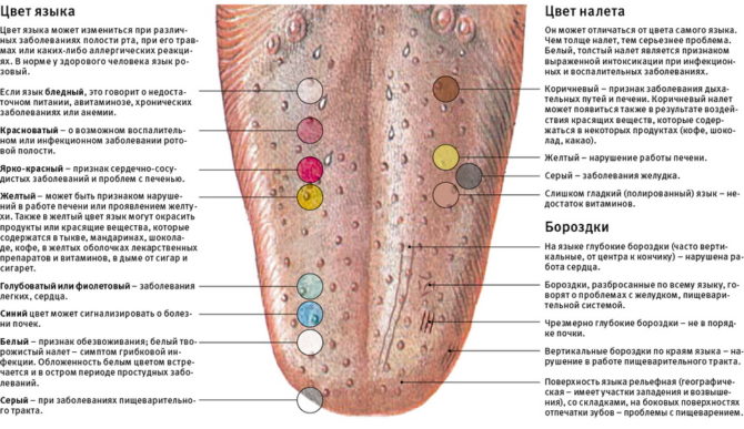 Manifestations dans la langue et diagnostics possibles