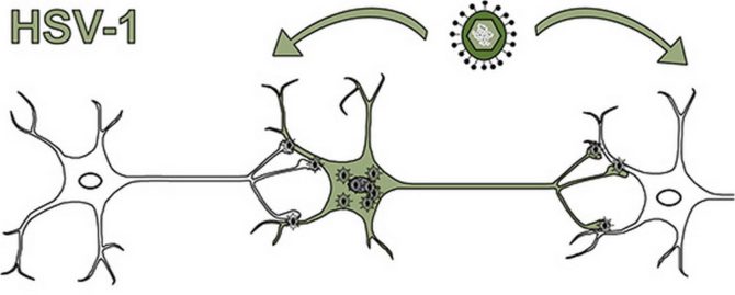 Propagation du virus de l'herpès