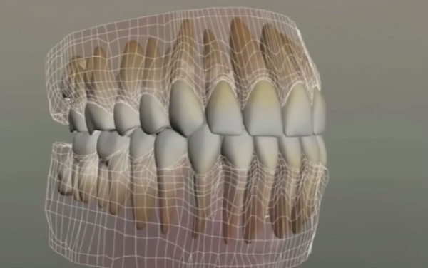 Ang scheme ng molars