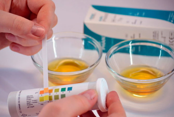 Bandelettes de test d'urine acétone