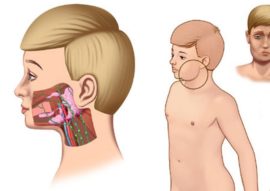 Ang mga inflamed lymph node na may mga baso ng pump