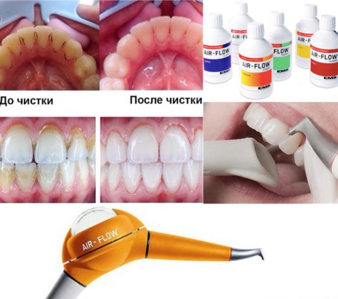 Débit d'air de brossage des dents