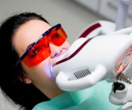 Blanchiment des dents au laser