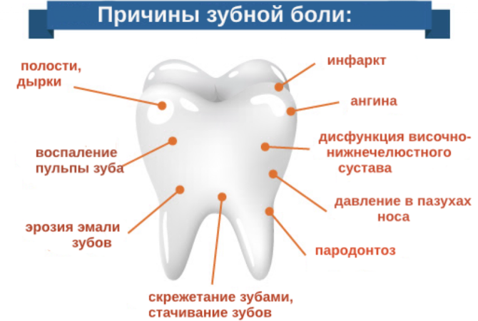 Mga Sanhi ng Toothache